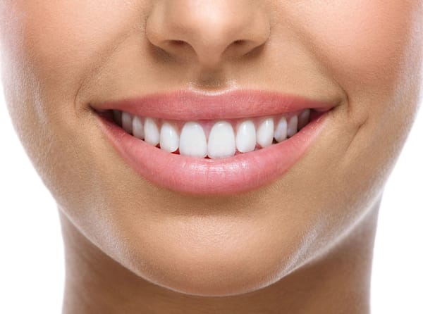 Understanding Teeth Whitening Options